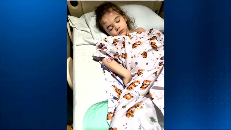 A bus driver accused of running over a 5-year-old girl has been placed on paid leave.