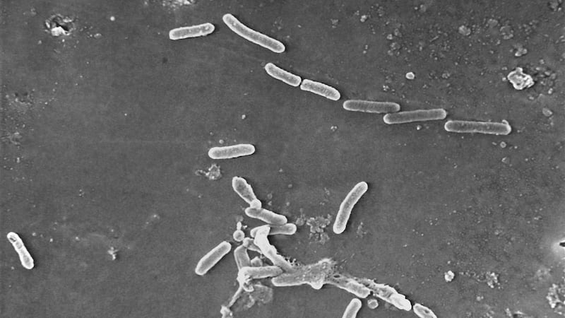 Esta imagen de microscopio electrónico proporcionada por los Centros para el Control y la...