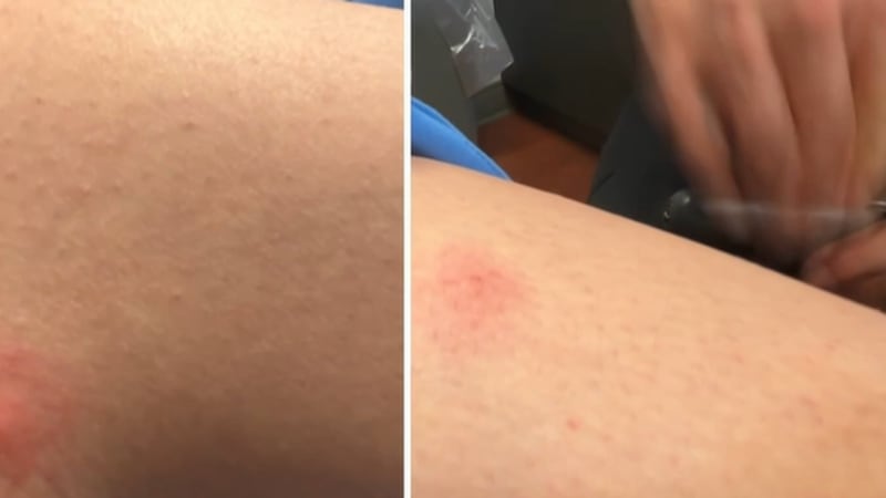 Comedian Luenell was hospitalized for a week after developing a serious infection from...