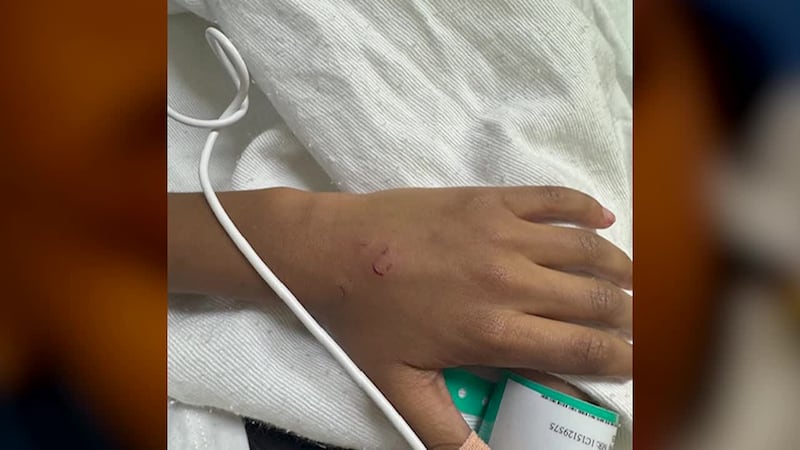 Niño de 8 años apuñalado en la frente con un lapicero por otro estudiante, dice su madre