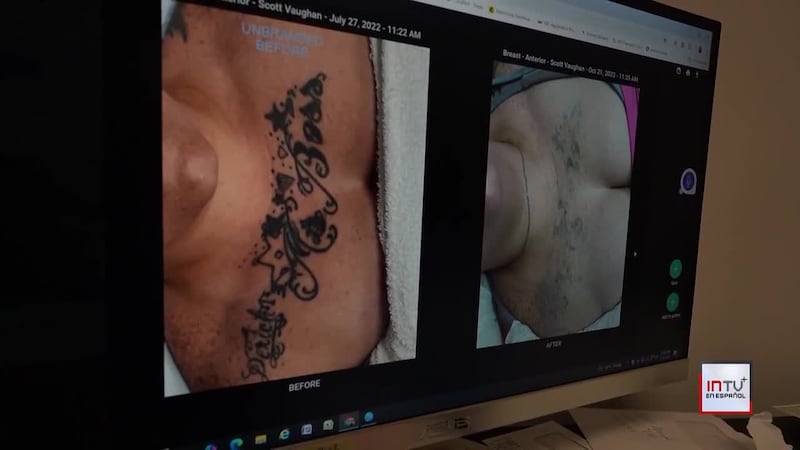 El médico que borra las marcas del abuso