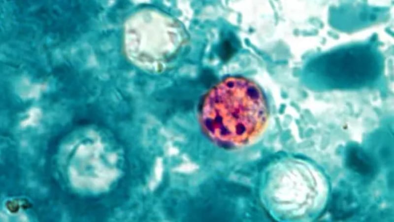 El Distrito de Salud del Sur de Nevada informa sobre un segundo caso de ciclosporiasis en un...