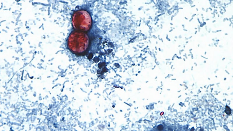 El Distrito de Salud del Sur de Nevada informa sobre un tercer caso de ciclosporiasis en un...